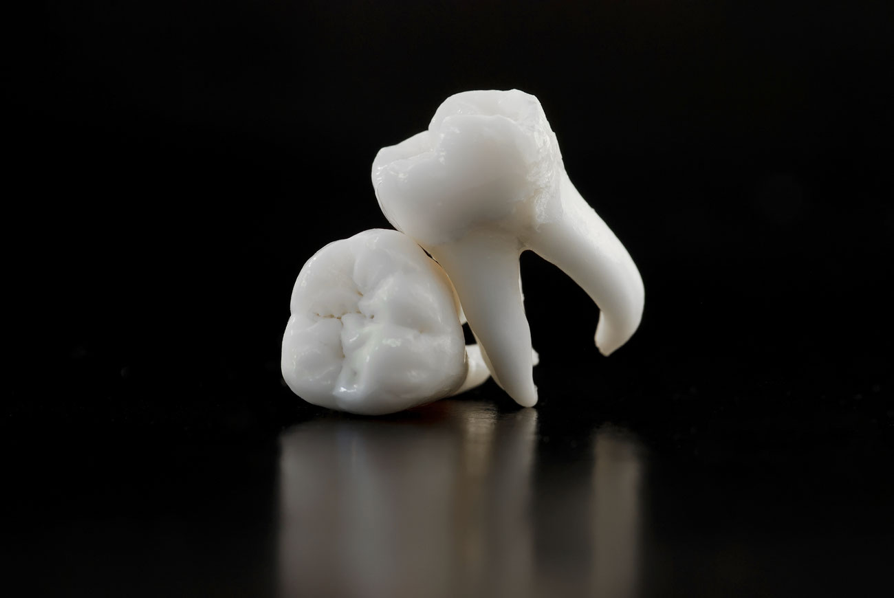Oralchirurgie